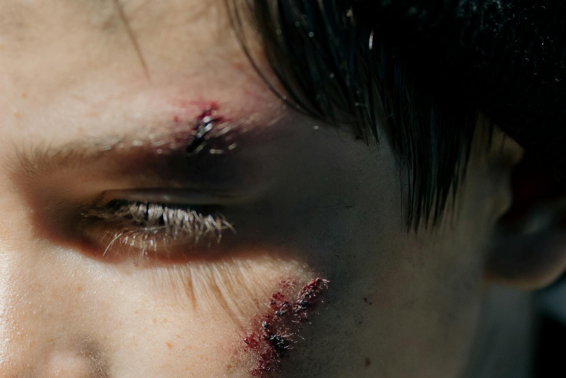 Wound Care Best Practices That Save Healing Time