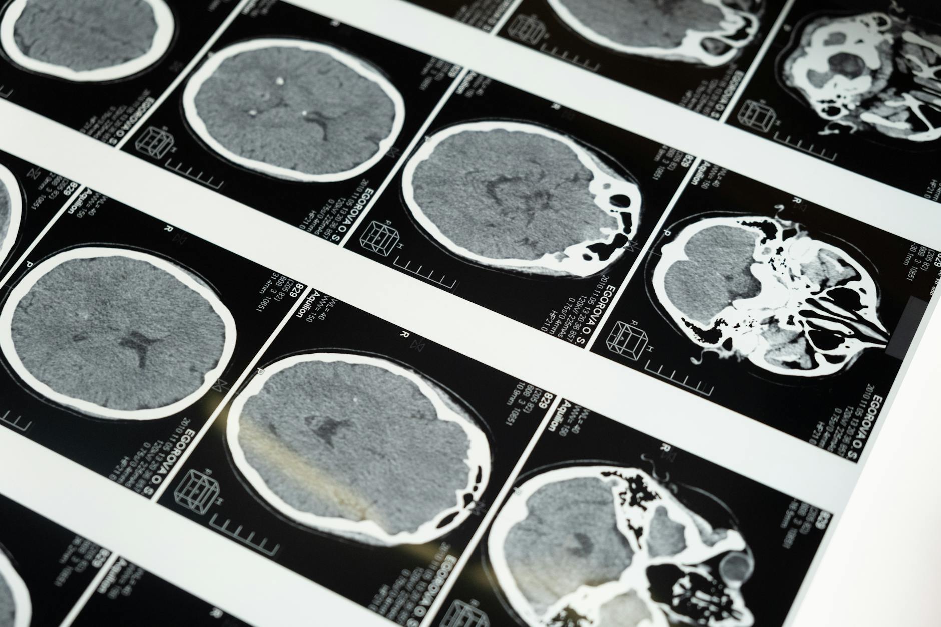 Mental Cognition, Mood, and the Neurological Benefits of Regular Riding